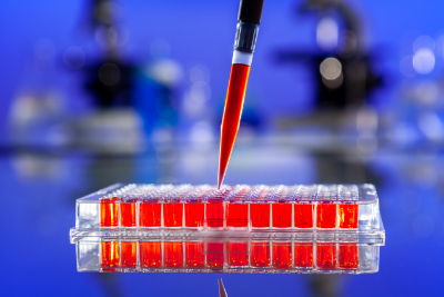 aids_cell_plate