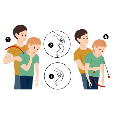 graphic showing steps to perform heimlich maneuver